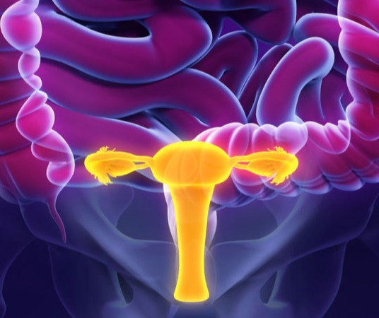 A endometriose - InVideo